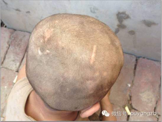 洪波的脑袋上，满是母亲殴打留下的伤痕。