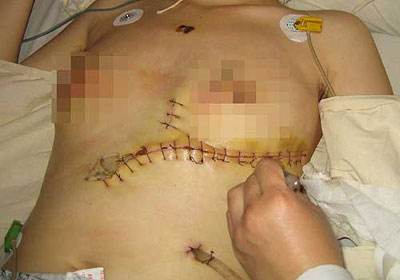 ɫ��!�������Ů��ǰȥ��ֹ �ز����Է���ҧ��