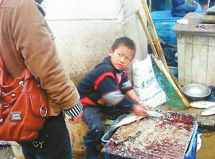 “杀鱼弟”饮百草枯自杀，肾脏损坏，已进入尿毒症期