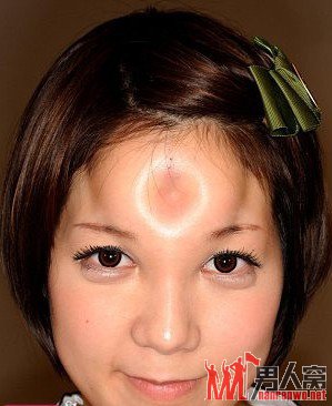变态日本额头注射“面包圈” 另类美容伤不起