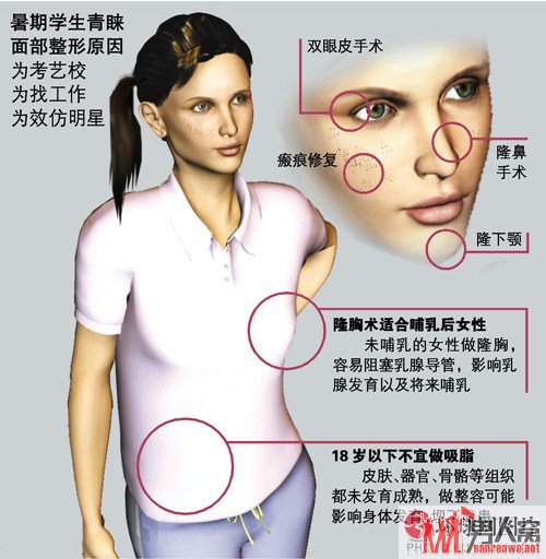  考生成绩优异父母奖励割双眼皮
