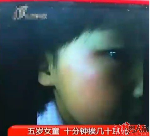 受伤女童