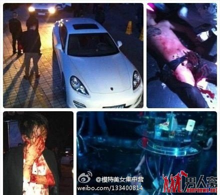 酒吧一帅气男子被当场阉割 疑似黑社会互殴