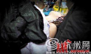 男子开玩笑过头 剪刀刺进妻子乳房7厘米