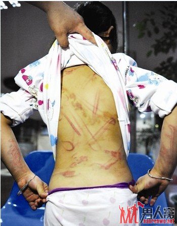 7岁女孩遍体鳞伤路边被罚站 母亲：她爱撒谎才痛下狠手