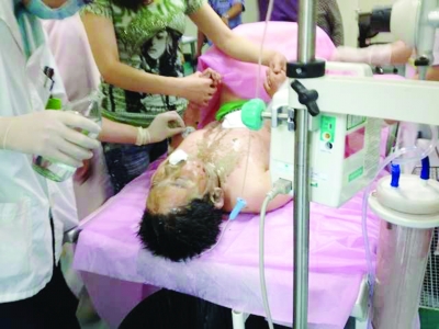 11岁男孩被母亲前男友泼强酸 可能是因情感纠葛