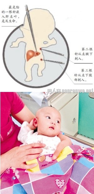 针扎女婴父亲判10年：疑女儿非亲生