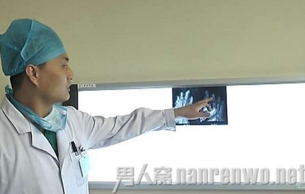 女童仿大人切菜切掉4指 女童仿大人切菜切掉4指