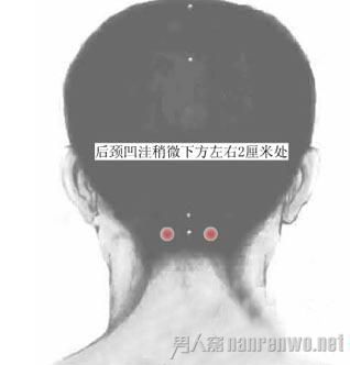 天柱穴