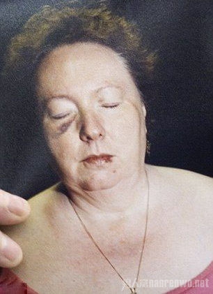 女护士遭暗杀徒手掐死杀手