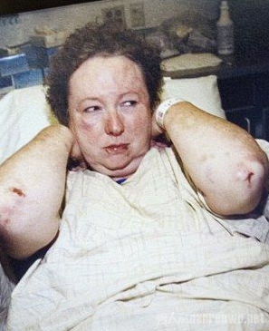 女护士遭暗杀徒手掐死杀手