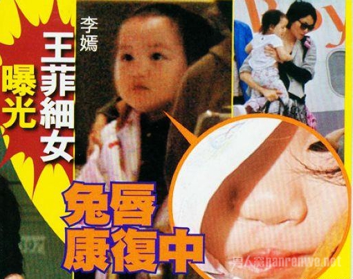王菲女儿李嫣兔唇