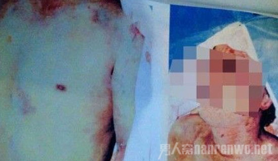 云南男子获释后漂尸鱼塘