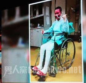 Selina参与《开讲啦》 分享不堪回首的烧伤经历