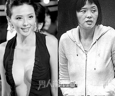 萧淑慎吸毒前后对比照