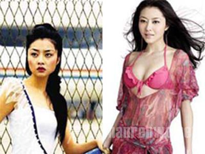 熊黛林整容前后对比照长这样？