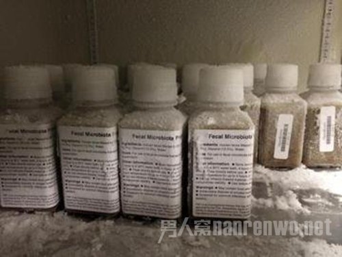 带有微生物的粪便样本