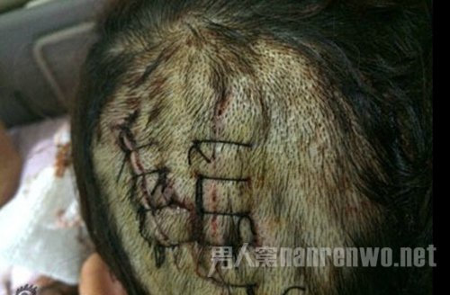 经纪人还原叶璇宠物狗伤人真相 巨春雷借机炒作