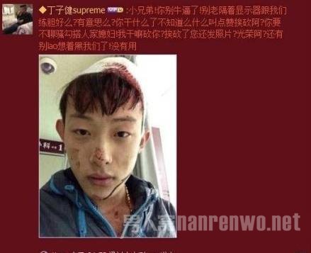 男子给别人媳妇点赞遭砍伤