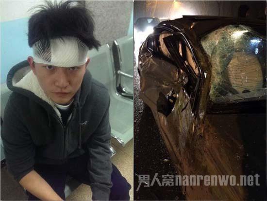 黄安儿子与被撞奔驰车