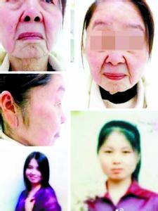 80后美少女分娩后变60岁老太
