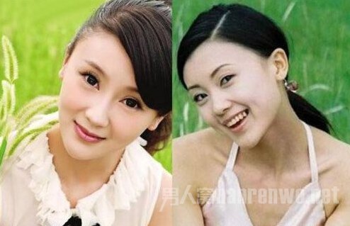 甘薇整容过吗?