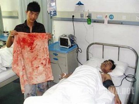 男生耍酒疯打伤老师左眼 男生耍酒疯打伤老师左眼