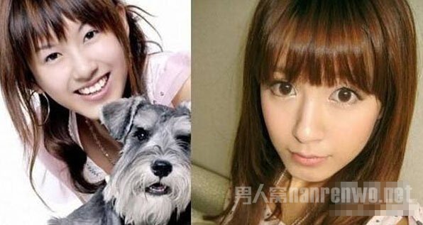 疑张子萱整容前后照曝光