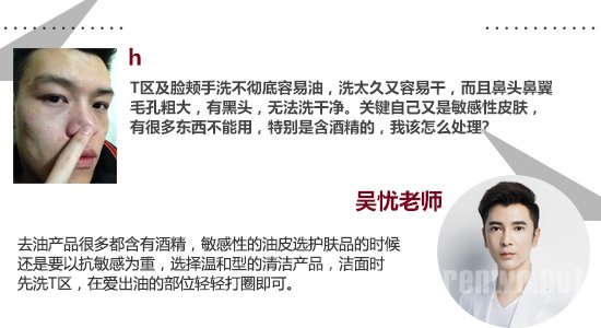 专家教你解决12个常见洁面问题