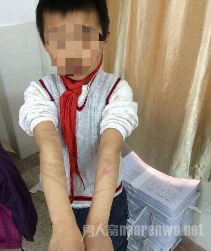 南京养父母虐待男童