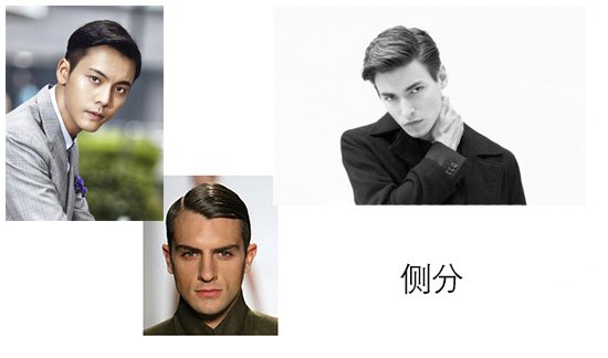侧分发型