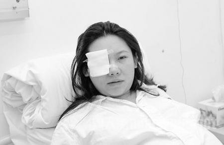 ��ޱ�ձ�����װ�¼��ܲ߻���ѩ