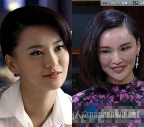 网曝整容失败之明星莫小棋