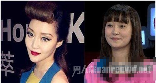 网曝整容失败之明星徐海星