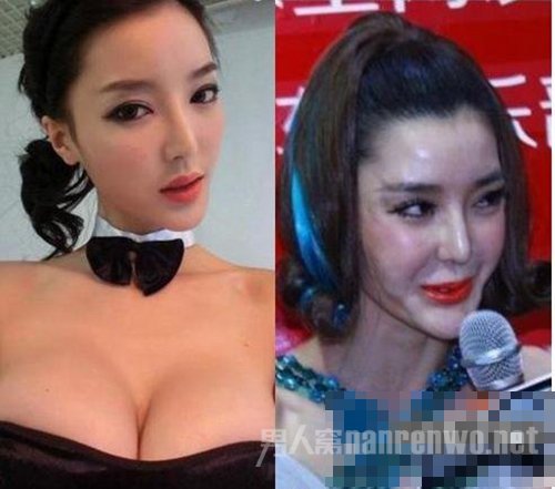 网曝整容失败之明星李颖芝