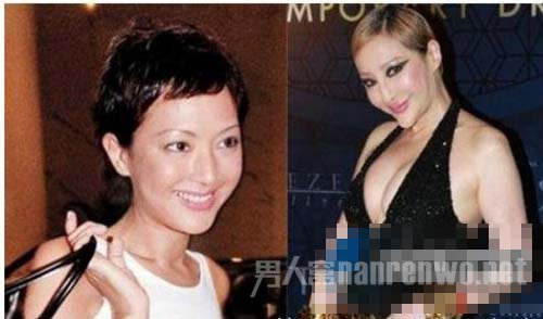 网曝整容失败之明星薛芷伦