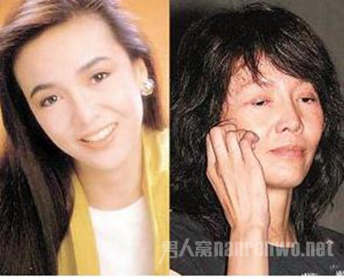 网曝整容失败之明星郑裕玲