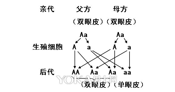 基因决定单双眼皮