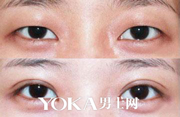 视错觉