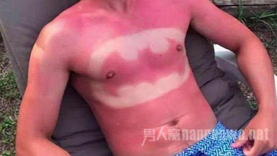 前胸晒伤艺术 前胸晒伤艺术