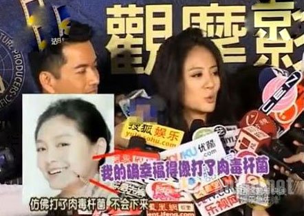 安以轩炮轰大S打肉毒