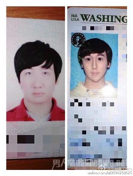 “蛇精男”整容前后