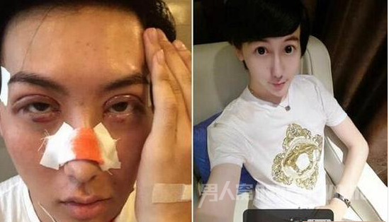 蛇精男爆整容图片