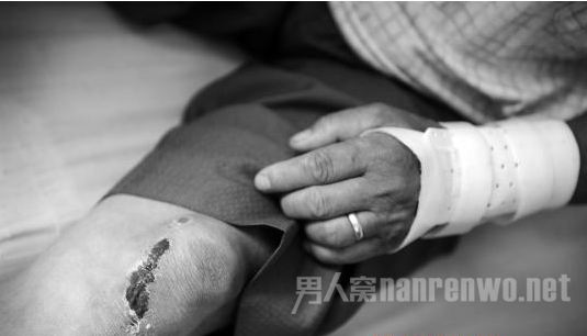 烧烤摊老板遭暴打骨折