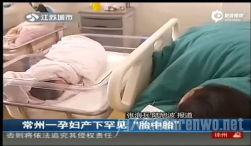 为何会产生胎中胎