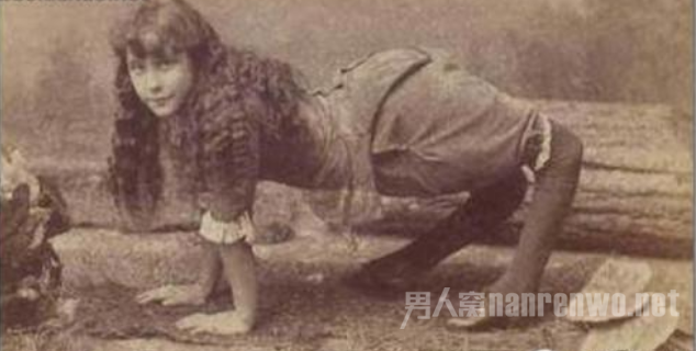 世界人类史上的十大怪胎骆驼女孩