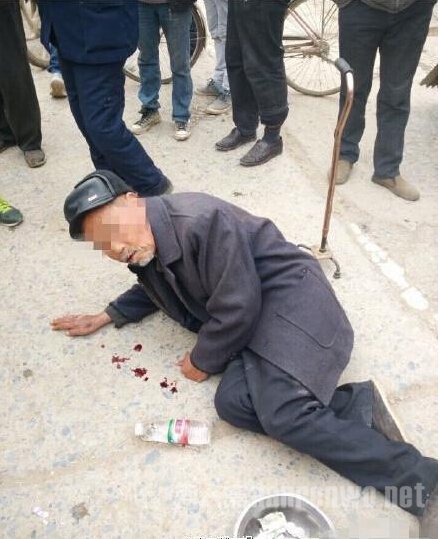 安徽老人“吐血“乞讨