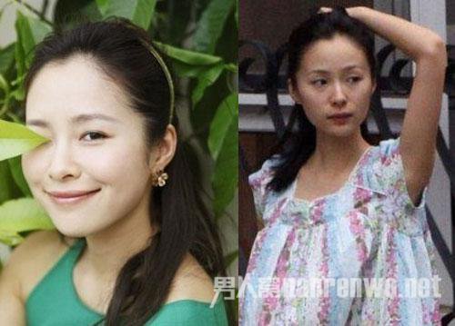 江一燕整容了？