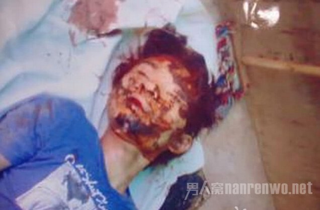 少年染紫发遭围殴身亡