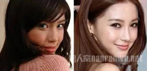 Angelababy的鼻子前后对比照